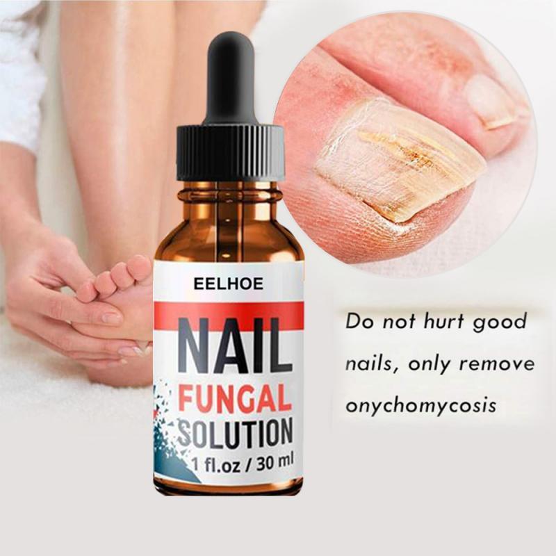 Hand and Foot Onychomycosis Care And Repair Liquid