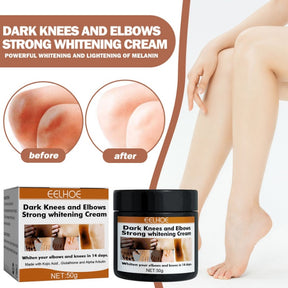 EELHOE Joint Darkening & Brightening Cream Moisturizing & Brightening Dark Skin Joint & Elbow Repair Cream